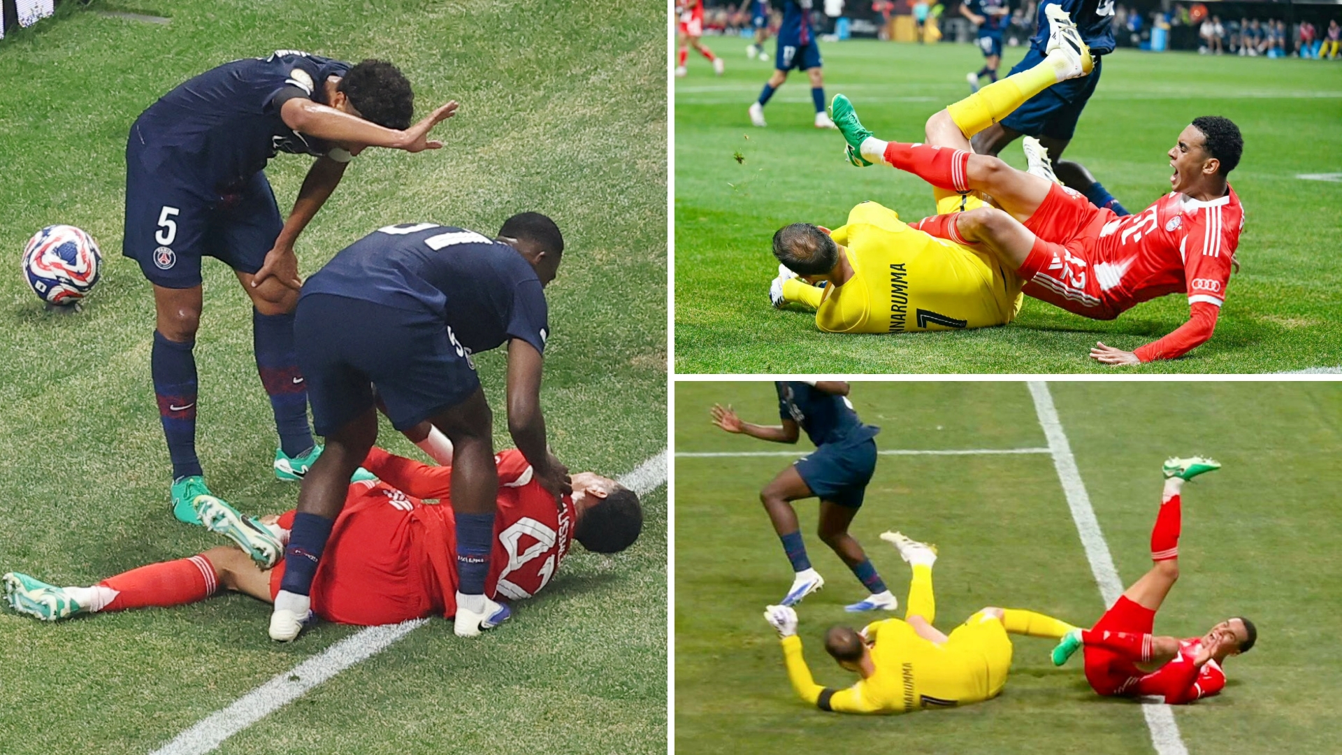 拜仁慕尼黑队员受伤无法参与欧冠联赛